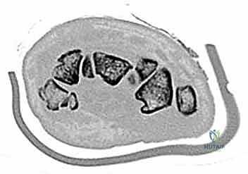 Clinical Image