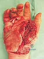 Clinical Image