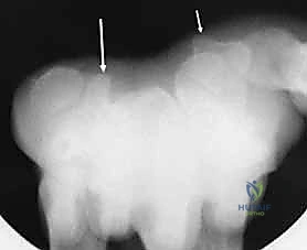 Clinical Image