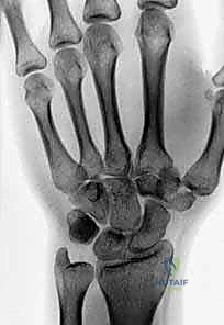 Clinical Image