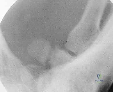 Clinical Image