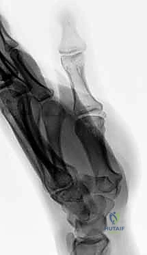 Clinical Image