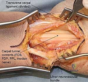 Clinical Image