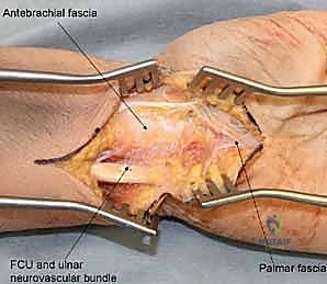 Clinical Image