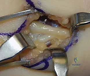 Clinical Image