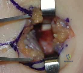 Clinical Image