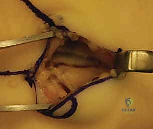 Clinical Image
