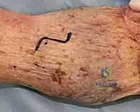 Clinical Image
