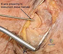 Clinical Image