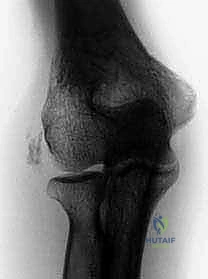 صورة توضح دقة العمل بالمنظار