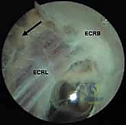 صورة لخيارات العلاج