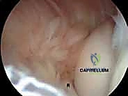 صورة توضيحية للأعراض