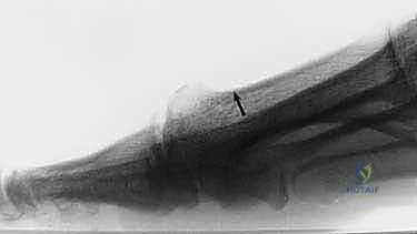 Clinical Image