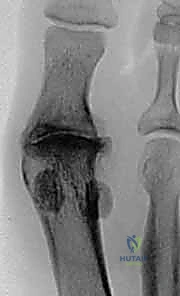 Clinical Image