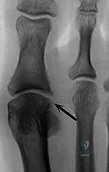 Clinical Image