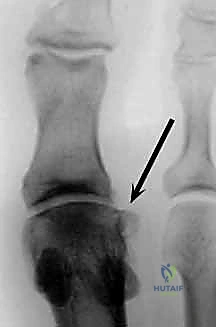 Clinical Image