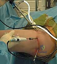 Clinical Image