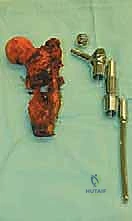 توضيح للأوعية الدموية والأعصاب الحساسة في منطقة الفخذ