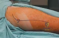 الأستاذ الدكتور محمد هطيف أثناء دراسة صور الأشعة للمريض