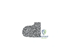 صورة طبية: استئصال عظم الفخذ وإعادة البناء بالطرف الاصطناعي: دليل شامل للمرضى مع الأستاذ الدكتور محمد هطيف في صنعاء