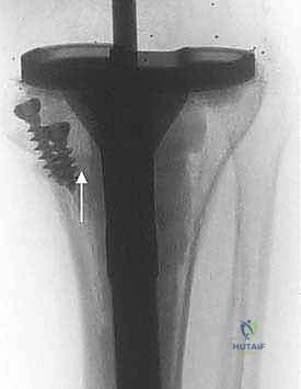 Clinical Image