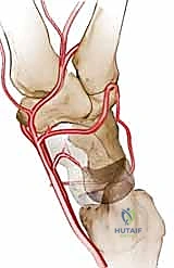 صورة توضيحية لـ مرض كينبوك وخشونة الرسغ: علاج متقدم بجراحة تطويل العظم الوعائي وتقصير العظم الكبير مع الأستاذ الدكتور محمد هطيف