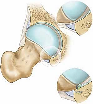 الحفرة الحقية والتكوين العظمي
