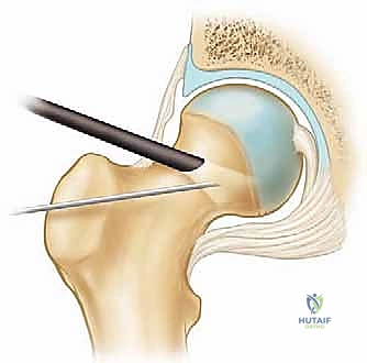 الأستاذ الدكتور محمد هطيف أثناء العمليات