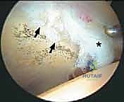 وضعية المريض والشد الجراحي