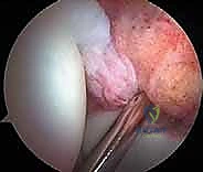 Clinical Image