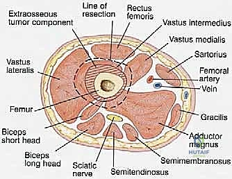 Clinical Image