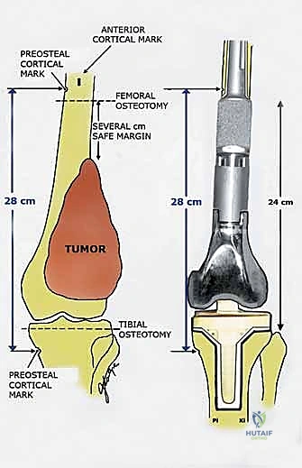 Clinical Image