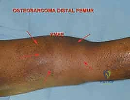 Clinical Image