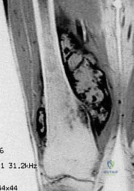 Clinical Image