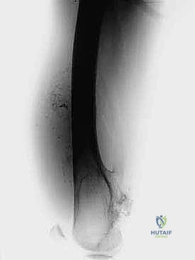 Clinical Image
