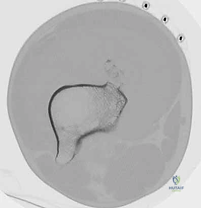 Clinical Image