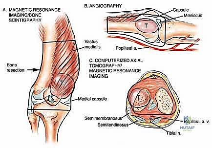 Skeletal Dysplasias: Anarchic Bone Development MCQs