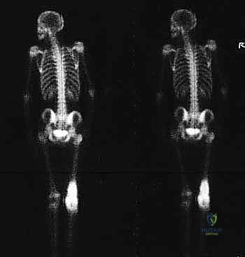 Clinical Image
