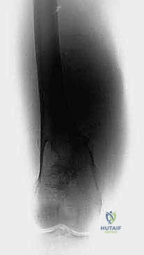 Clinical Image