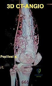 Clinical Image