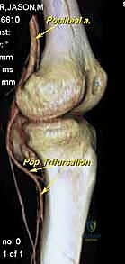 Clinical Image
