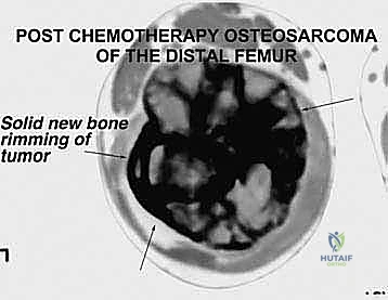 Clinical Image