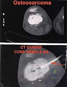 Clinical Image