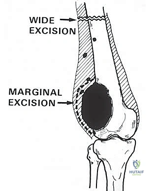 Clinical Image