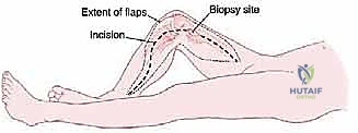 Clinical Image