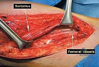 Clinical Image