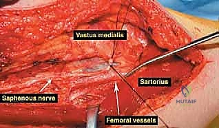 Clinical Image
