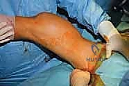 Clinical Image
