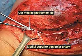 Clinical Image