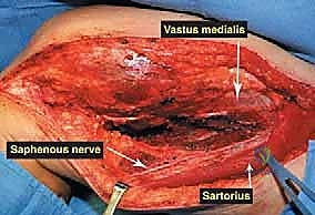 Clinical Image